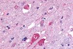 GALR2 Antibody in Immunohistochemistry (Paraffin) (IHC (P))