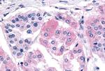 GHSR Antibody in Immunohistochemistry (Paraffin) (IHC (P))