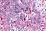 GHRHR Antibody in Immunohistochemistry (Paraffin) (IHC (P))