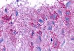 GPR101 Antibody in Immunohistochemistry (Paraffin) (IHC (P))