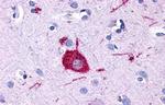 GPR116 Antibody in Immunohistochemistry (Paraffin) (IHC (P))