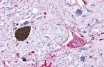 GPR116 Antibody in Immunohistochemistry (Paraffin) (IHC (P))