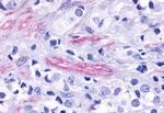 TEM5 Antibody in Immunohistochemistry (Paraffin) (IHC (P))