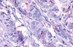 TEM5 Antibody in Immunohistochemistry (Paraffin) (IHC (P))