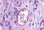 TEM5 Antibody in Immunohistochemistry (Paraffin) (IHC (P))