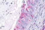 TEM5 Antibody in Immunohistochemistry (Paraffin) (IHC (P))