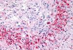 GPR133 Antibody in Immunohistochemistry (Paraffin) (IHC (P))