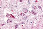 GPR133 Antibody in Immunohistochemistry (Paraffin) (IHC (P))