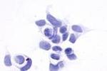 GPR161 Antibody in Immunocytochemistry (ICC/IF)