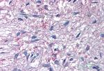 GPR50 Antibody in Immunohistochemistry (Paraffin) (IHC (P))