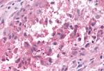 GPR50 Antibody in Immunohistochemistry (Paraffin) (IHC (P))