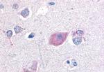 GPR55 Antibody in Immunohistochemistry (Paraffin) (IHC (P))