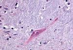 GPR55 Antibody in Immunohistochemistry (Paraffin) (IHC (P))