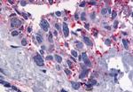 GPR56 Antibody in Immunohistochemistry (Paraffin) (IHC (P))