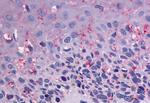 GPR56 Antibody in Immunohistochemistry (Paraffin) (IHC (P))