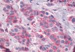 GPR56 Antibody in Immunohistochemistry (Paraffin) (IHC (P))