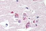 GPR98 Antibody in Immunohistochemistry (Paraffin) (IHC (P))