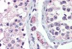 GPR98 Antibody in Immunohistochemistry (Paraffin) (IHC (P))