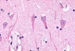 GPR98 Antibody in Immunohistochemistry (Paraffin) (IHC (P))