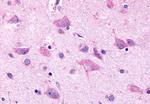 GPR98 Antibody in Immunohistochemistry (Paraffin) (IHC (P))