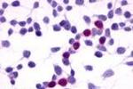 RAI3 Antibody in Immunocytochemistry (ICC/IF)