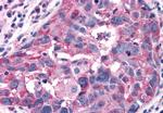 RAI3 Antibody in Immunohistochemistry (Paraffin) (IHC (P))