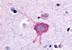 mGluR2 Antibody in Immunohistochemistry (Paraffin) (IHC (P))