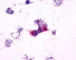 mGluR2 Antibody in Immunocytochemistry (ICC/IF)