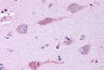 mGluR3 Antibody in Immunohistochemistry (Paraffin) (IHC (P))