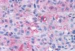 mGluR4 Antibody in Immunohistochemistry (Paraffin) (IHC (P))