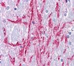 mGluR4 Antibody in Immunohistochemistry (Paraffin) (IHC (P))