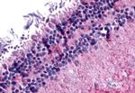 mGluR6 Antibody in Immunohistochemistry (Paraffin) (IHC (P))