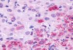 LHR Antibody in Immunohistochemistry (Paraffin) (IHC (P))