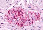 LHR Antibody in Immunohistochemistry (Paraffin) (IHC (P))