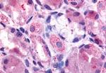 HRH2 Antibody in Immunohistochemistry (Paraffin) (IHC (P))