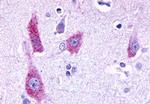 HTR6 Antibody in Immunohistochemistry (Paraffin) (IHC (P))