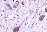 HTR6 Antibody in Immunohistochemistry (Paraffin) (IHC (P))