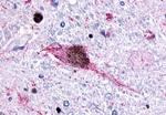 HTR6 Antibody in Immunohistochemistry (Paraffin) (IHC (P))