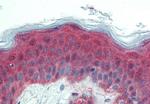 ITGA3 Antibody in Immunohistochemistry (Paraffin) (IHC (P))