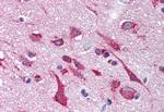 KCNH2 Antibody in Immunohistochemistry (Paraffin) (IHC (P))