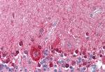 KCNMA1 Antibody in Immunohistochemistry (Paraffin) (IHC (P))