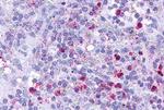 LTB4R Antibody in Immunohistochemistry (Paraffin) (IHC (P))