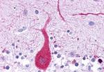 LTB4R Antibody in Immunohistochemistry (Paraffin) (IHC (P))