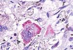 LGR4 Antibody in Immunohistochemistry (Paraffin) (IHC (P))