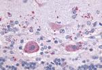 LPAR4 Antibody in Immunohistochemistry (Paraffin) (IHC (P))