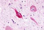 LPHN3 Antibody in Immunohistochemistry (Paraffin) (IHC (P))