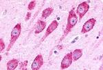 LPHN3 Antibody in Immunohistochemistry (Paraffin) (IHC (P))