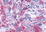 LTB4R2 Antibody in Immunohistochemistry (Paraffin) (IHC (P))