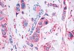 MAS1 Antibody in Immunohistochemistry (Paraffin) (IHC (P))