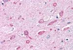 MC4R Antibody in Immunohistochemistry (Paraffin) (IHC (P))